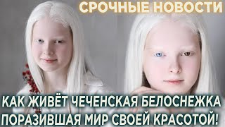 Как сейчас живёт чеченская Белоснежка поразившая мир своей красотой!