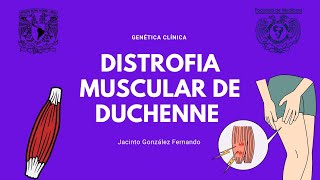 Distrofia Muscular de Duchenne