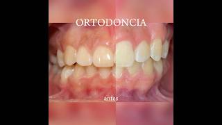 ORTODONCIA