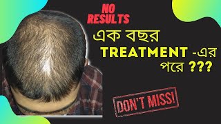 No Results After 1 Year Treatment  | PRP Treatment | Niramoy Clinic