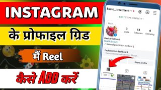 Instagram Reels Not Showing Profile Grid | how to show Instagram reel in the profile grid |