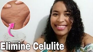 CELULITE COMO ELIMINAR