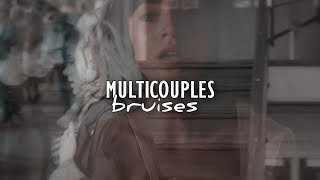 multicouples | bruises  [+1K]