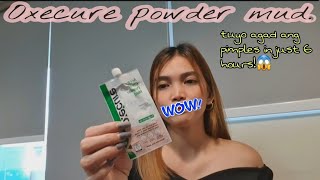 TUYO AGAD ANG PIMPLES IN 6 HOURS! OXECURE ACNE CLEAR POWDER MUD REVIEW.