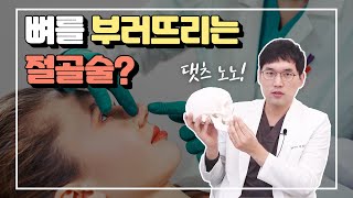 뼈를 부러뜨리는 절골술?! 코 절골술을 하는경우와 하면 안되는 경우가 있다!(osteotomy, nasal bone reduction)