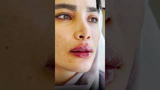 مهم‌ترین دغدغه در تزریق لب#beauty