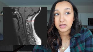 BRAIN DISORDER UPDATE! Scheduling Brain Surgery & Making a Plan for Labor