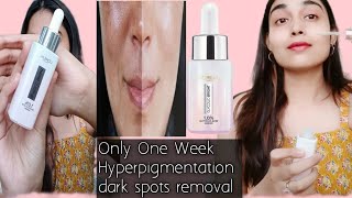 Dark Spots Nd Hyperpigmentation Solution Loreal Glycolic Range Honest Review