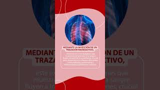 Gammagrama Pulmonar y la #medicinanuclear ¿Habías escuchado de este estudio?