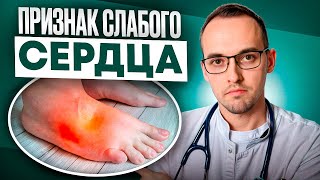 7 ПРИЗНАКОВ СЛАБОГО СЕРДЦА. Предотврати сердечную недостаточность, пока не поздно