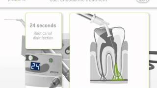 W&H ● Prozone - 24 seconds endodontic treatment