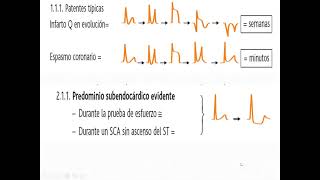 ECG en enfermedad coronaria