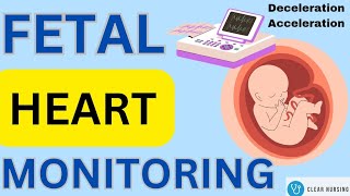 Fetal Heart Rate Monitoring Interpretation| Acceleration|Deceleration। Early,Variable,Late #aiims