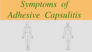 Adhesive Capsulitis Clinical Pattern