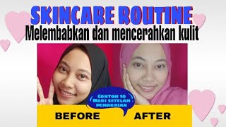 SKINCARE ROUTINE 2020 || Mengatasi Kulit Kering dan Berjerawat