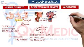 Resumen de patología esofágica 2023