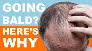 Facing Baldness? This Could Be The Reason!