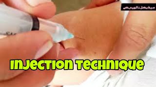 injection for allergy.injection avil,dexona|allergy treatment|medical knowledge pk