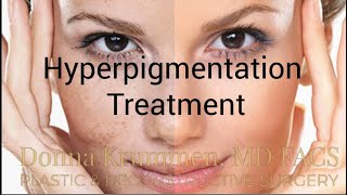 Hyperpigmentation Treatment