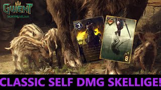 Self DMG Skellige With A Surprise Finisher Of Mega Points! | GWENT