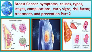 Breast Cancer  symptoms,causes,types,complications, stages,early signs,risk factor,treatment part-2