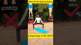 How To Fix Knock Knees 2023 ||#shorts #youtubeshorts #kneeexercise