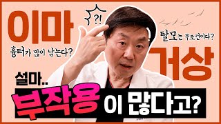 이마거상 하면 흉터에 탈모까지...? 걱정되는 이마거상 부작용, 팩트체크부터 해봅시다!! - 의학박사 백승준