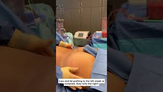 Patient Journey: Body Contouring for 34 year old patient