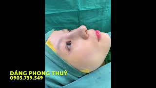 #phauthuatthammy #dangphongthuy #nangmuidep LAKI BEAUTY -  DÁNG PHONG THUỶ 0903739549