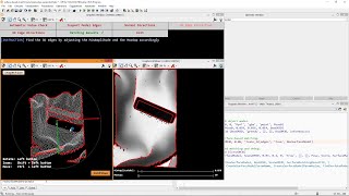 Edge-supported Surface-based 3D-Matching with MVTec HALCON