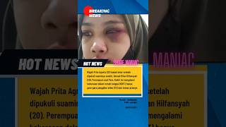 Wajah Prita Agneta babak belur setelah dipukuli suaminya sendiri