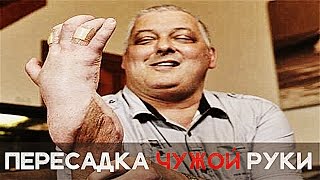 ПЕРЕСАДКА ЧУЖОЙ РУКИ [Шокирующая реальность #55]