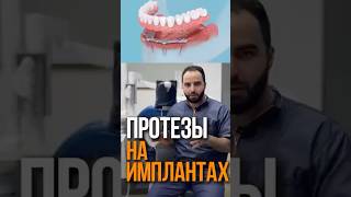 ПРОТЕЗЫ НА ИМПЛАНТАХ