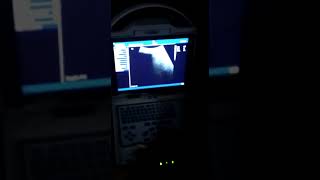 Goat ultrasound Animal ultrasound Karachi Dr Noman