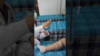 Treatment of vericose vien ||#health #vericoseveintreatment #virolshort