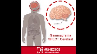 Gammagrama SPECT Cerebral