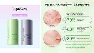 Masker mungil gampang digunakan untuk mencerahkan wajah, mengangkat komedo dan jerawat