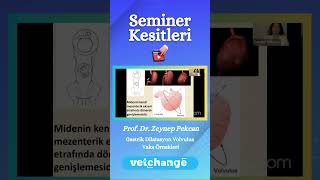 “Gastrik dilatasyon volvulus vaka örnekleri” Prof.Dr. Zeynep Pekcan #vetchange #veterinerhekim #vaka