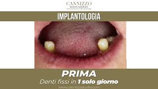 Implantologia ed Estetica Dentale - Studio Cannizzo