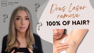 Does Laser hair remove 100% of your hair?