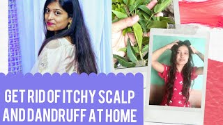 How do you get rid of itchy scalp and dandruff at home?