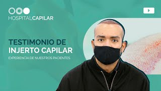 Testimonio de un INJERTO CAPILAR | La experiencia de nuestros pacientes 💯