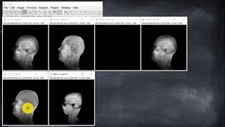 009 Opciones de visualización 2D y 3D de stacks (Curso ImageJ-Fiji)