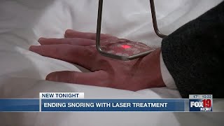 Ending snoring with laser treatment