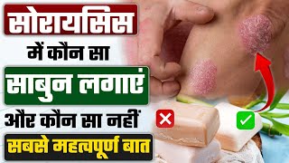 सोरायसिस बीमारी का इलाज | Psoriasis tips | सोरायसिस में कौन सा साबुन लगाएं और कौन सा नहीं