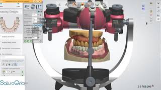 Everyday stuff with digital dentures made on intraoral scans.