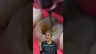 ENDODONCIA