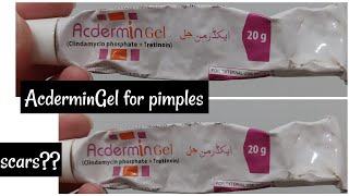 AcderminGel for pimples, scars & open pores