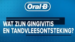 Oral-B | Wat zijn gingivitis en tandvleesontsteking?