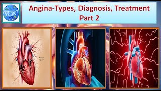 Angina  Types, Diagnosis, Treatment Part 2